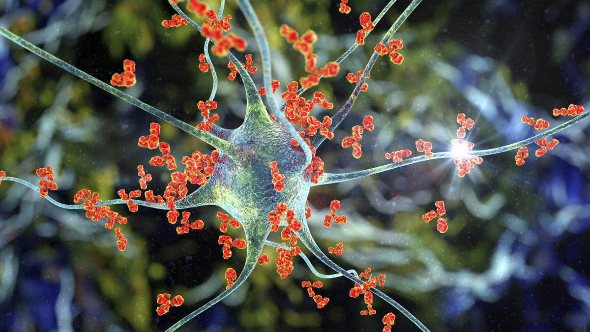 Disease X Hastaligi Nedir 1